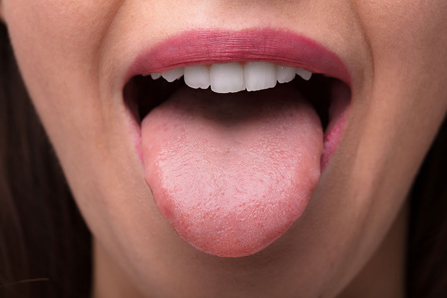 5：口臭のケアに「舌クリーニング」