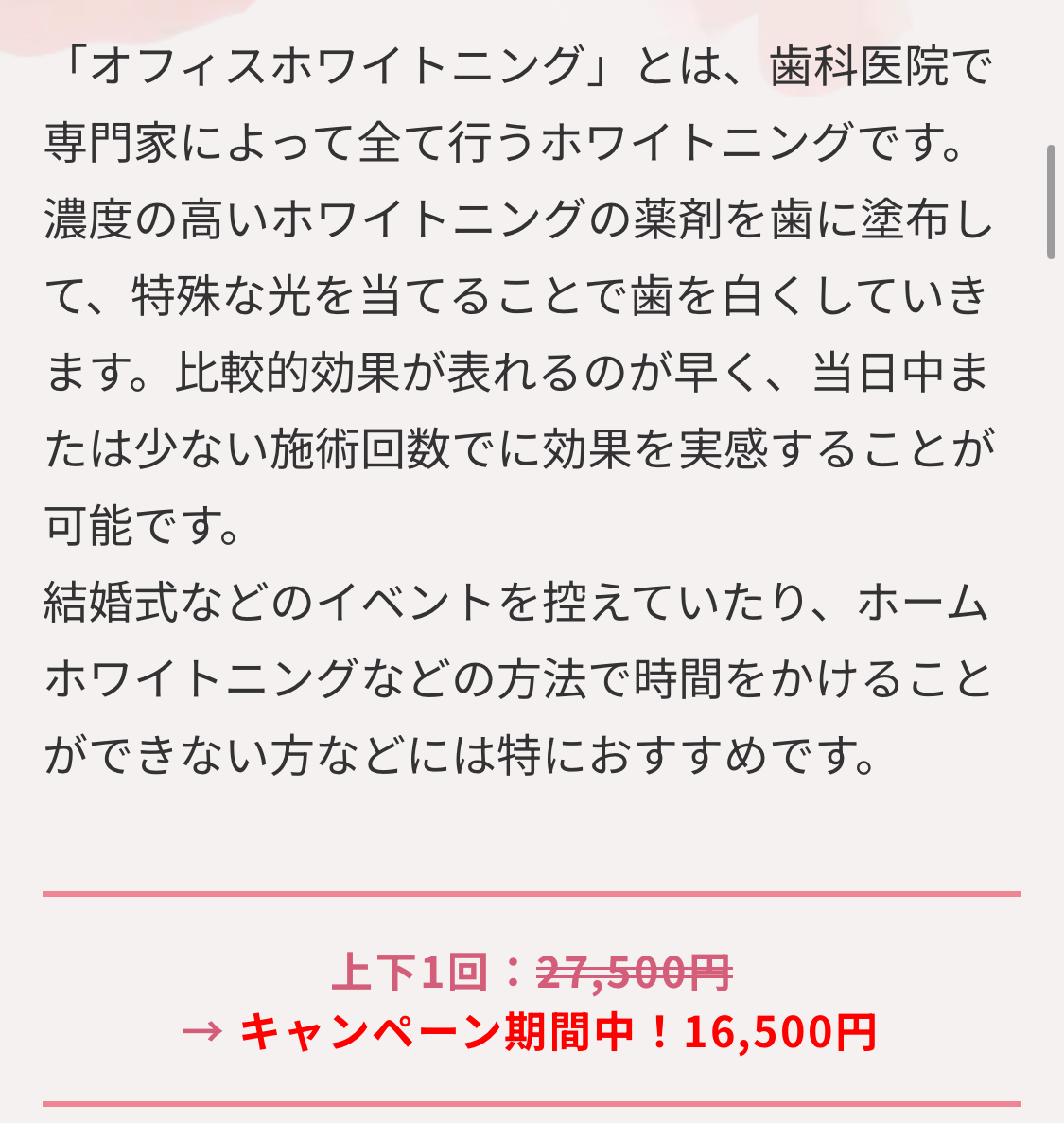 オフィスホワイトニング　期間限定でお安くなっています！